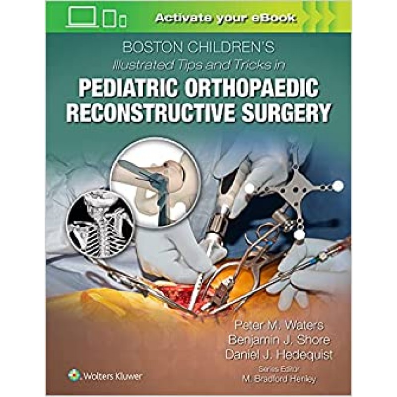 Boston Children's Illustrated Tips and Tricks in Pediatric Orthopaedic Reconstructive Surgery First edition