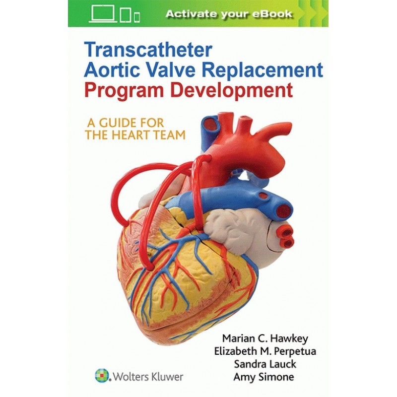 Transcatheter Aortic Valve Replacement Program Development: A Guide for the Heart Team