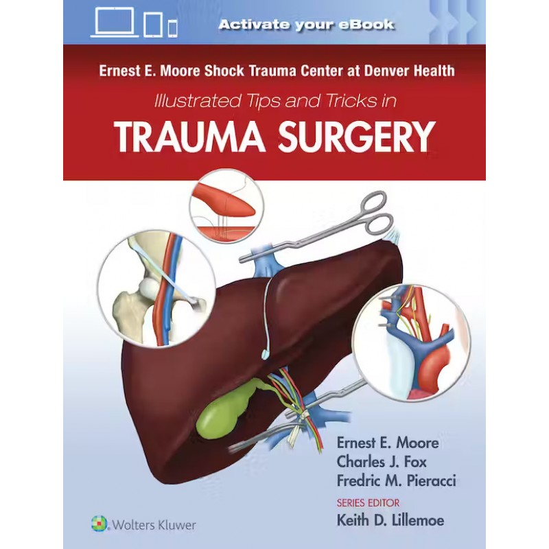 Ernest E. Moore Shock Trauma Center at Denver Health Illustrated Tips and Tricks in Trauma Surgery, 1st Edition