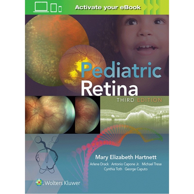 Pediatric Retina 3E