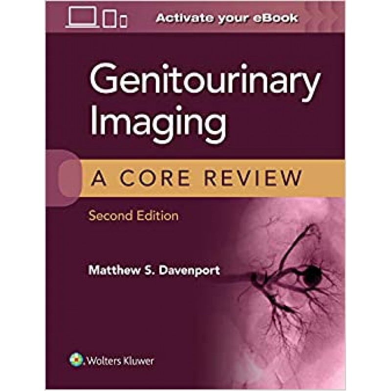 Genitourinary Imaging: A Core Review 2nd edition