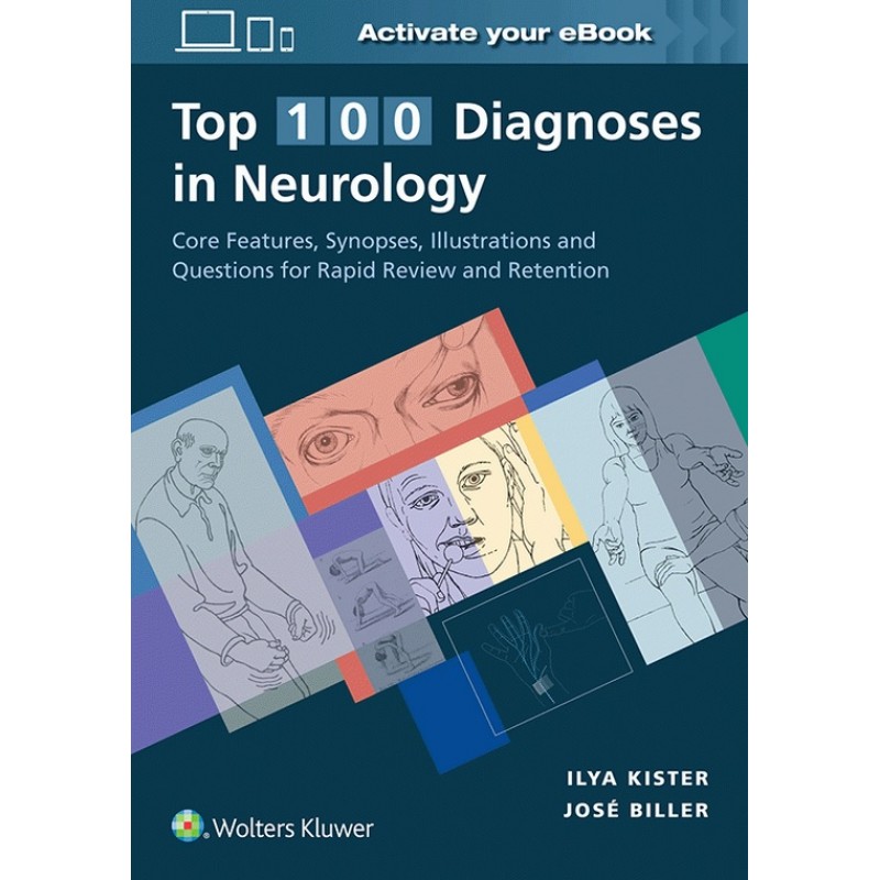 Top 100 Diagnoses in Neurology