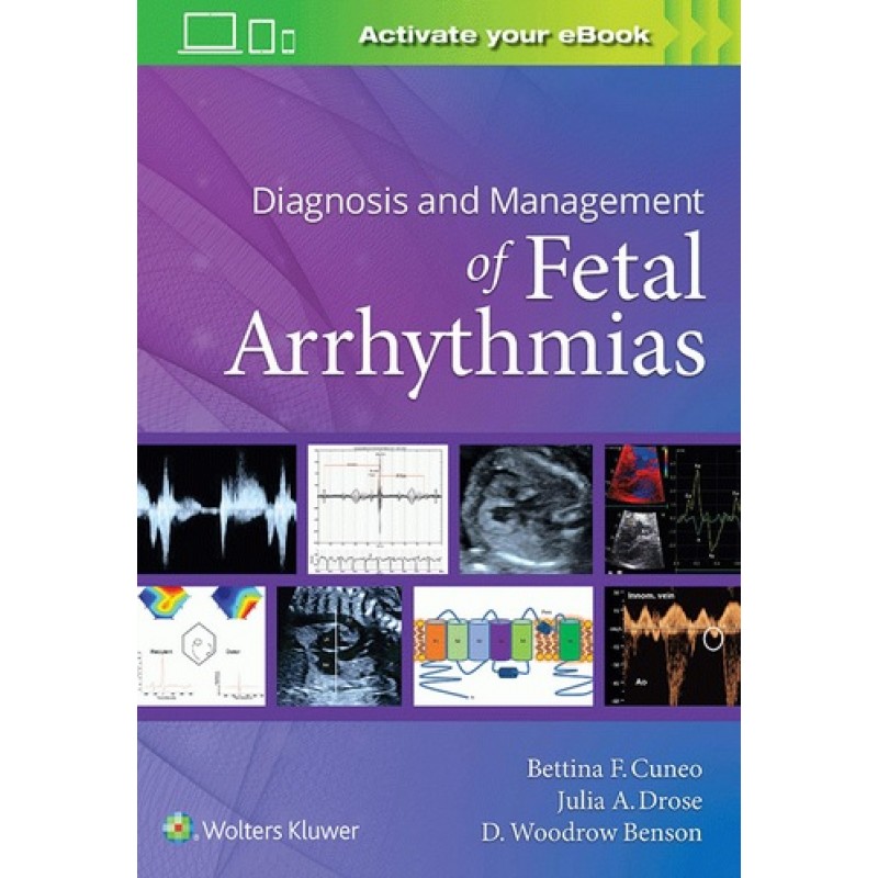 Diagnosis and Management of Fetal Arrhythmias