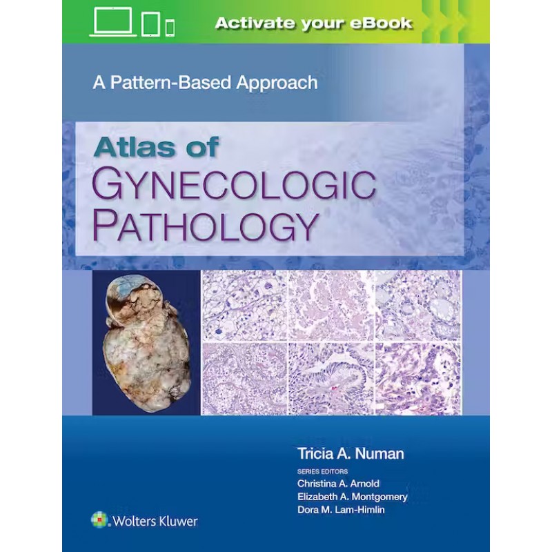 Atlas of Gynecologic: Pathology A Pattern-Based Approach, 1st Edition