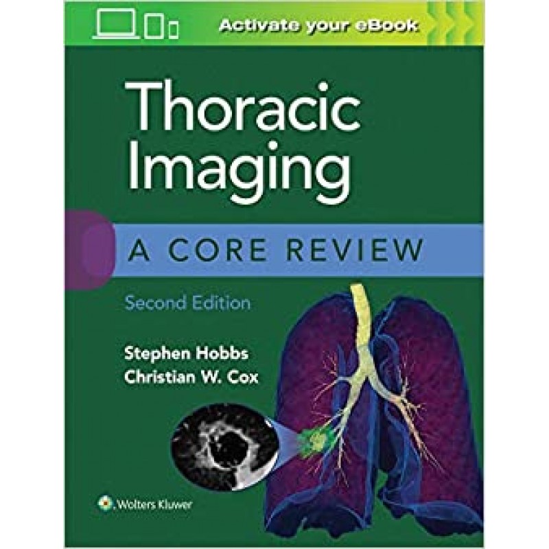 Thoracic Imaging: A Core Review 2nd edition