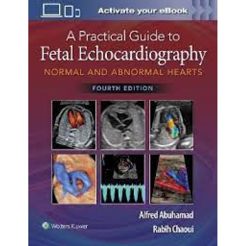 A Practical Guide to Fetal Echocardiography Normal and Abnormal Hearts 