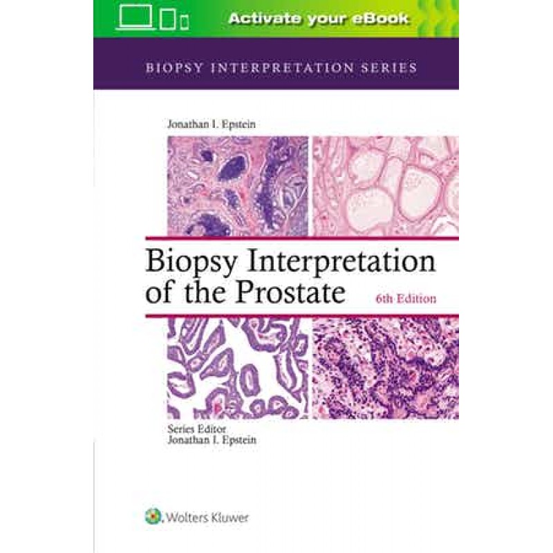 Biopsy Interpretation of the Prostate 6th edition