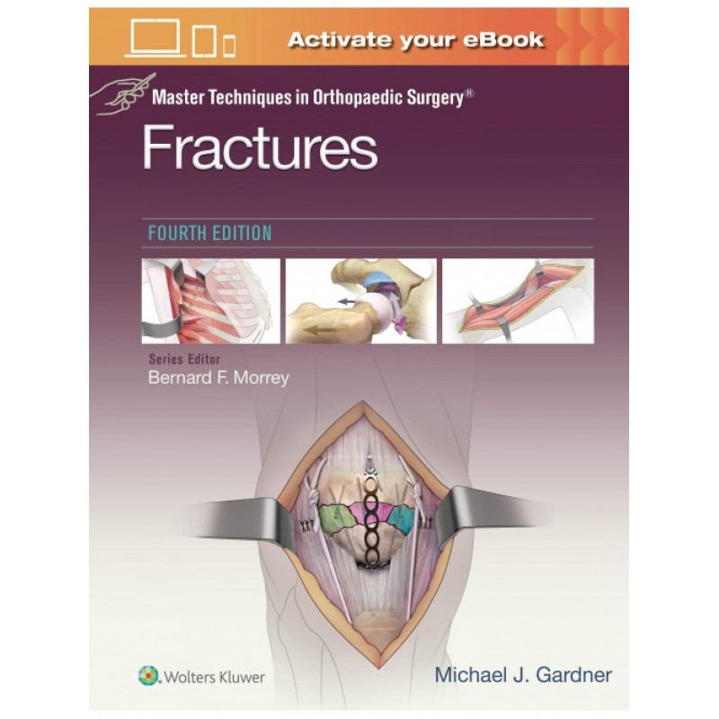 Master Techniques in Orthopaedic Surgery: Fractures 4E