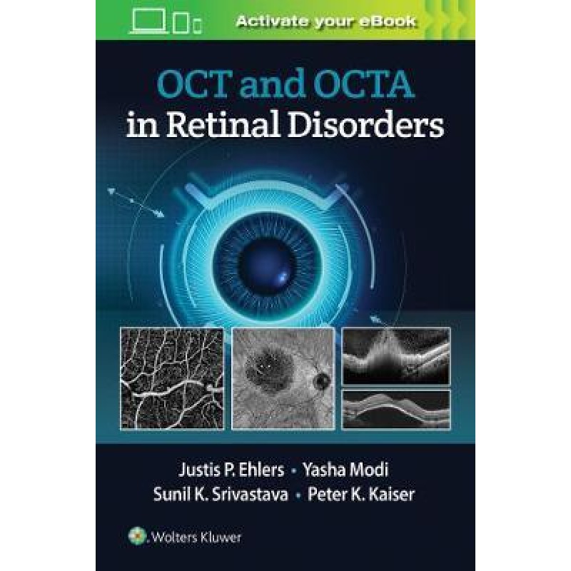 OCT and OCT Angiography in Retinal Disorders 