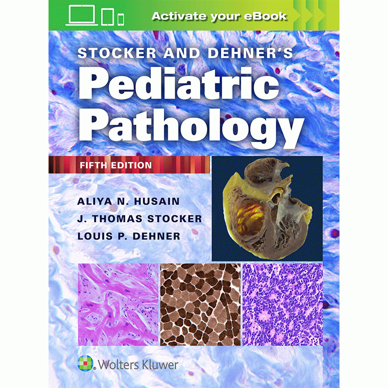 Stocker and Dehner’s Pediatric Pathology, 5E