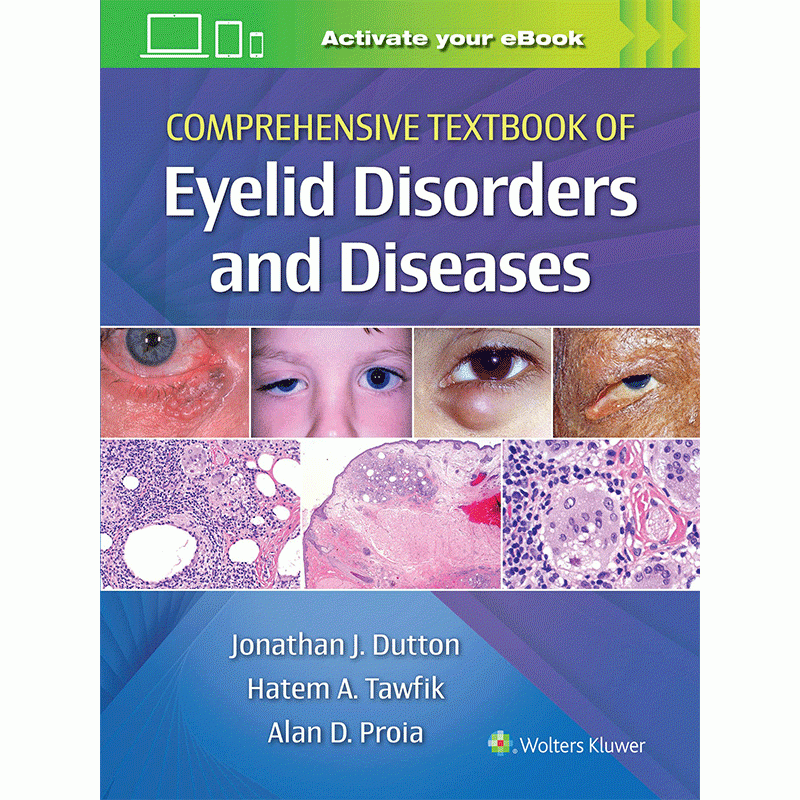 Comprehensive Textbook of Eyelid Disorders and Diseases