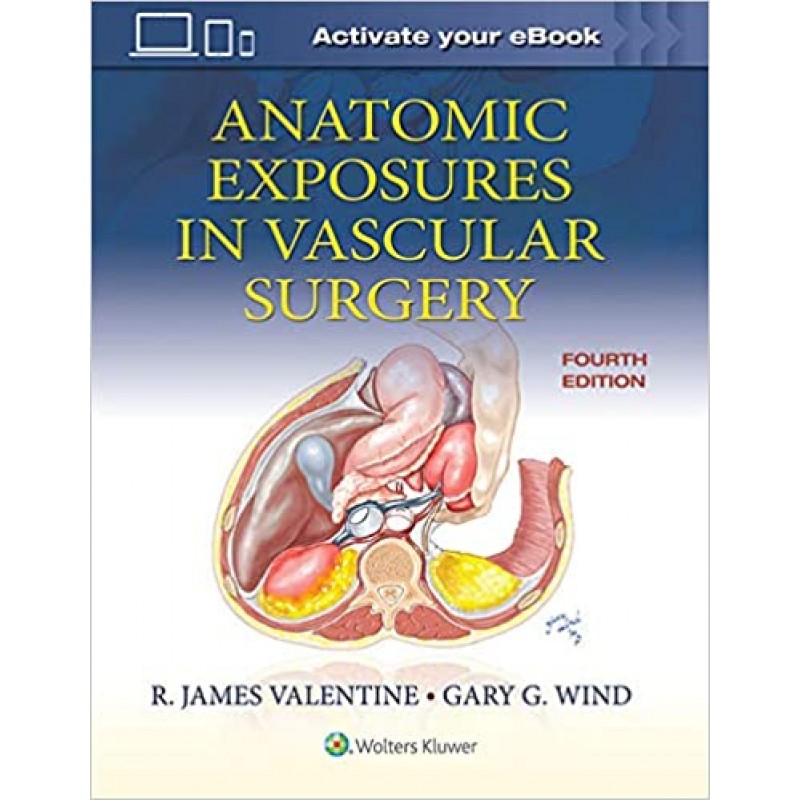 Anatomic Exposures in Vascular Surgery 4th Edition