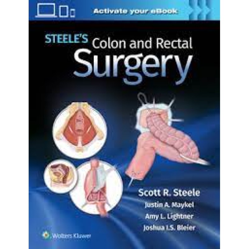 Steele's Colon and Rectal Surgery 1E