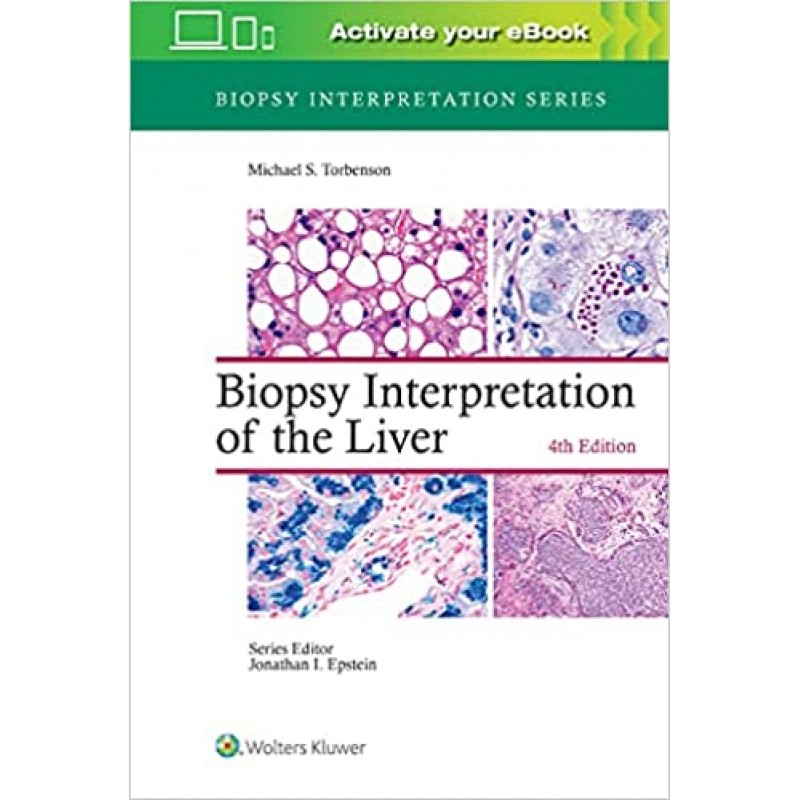 Biopsy Interpretation of the Liver 4E Biopsy Interpretation Series