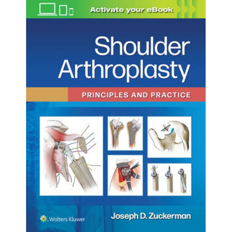 Shoulder Arthroplasty Principles and Practice, 1E