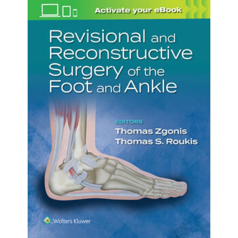 Revisional and Reconstructive Surgery of the Foot and Ankle First edition