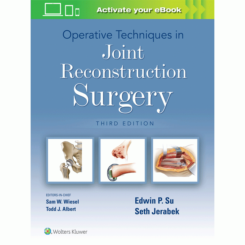 Operative Techniques in Joint Reconstruction Surgery, 3E