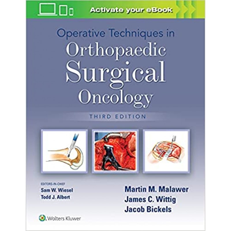 Operative Techniques in Orthopaedic Surgical Oncology 3E