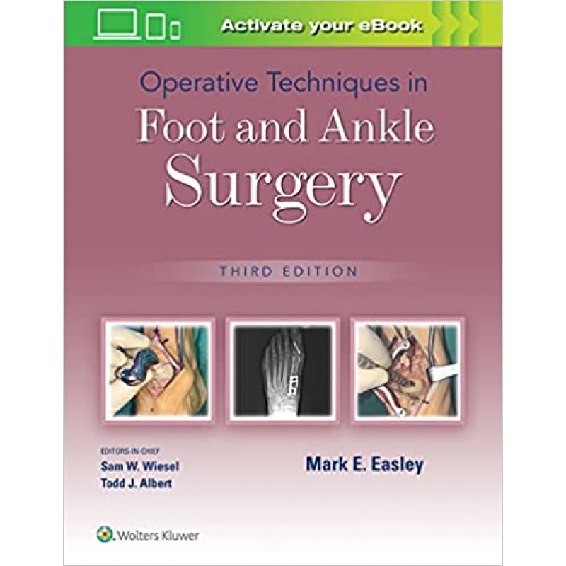 Operative Techniques in Foot and Ankle Surgery 3E