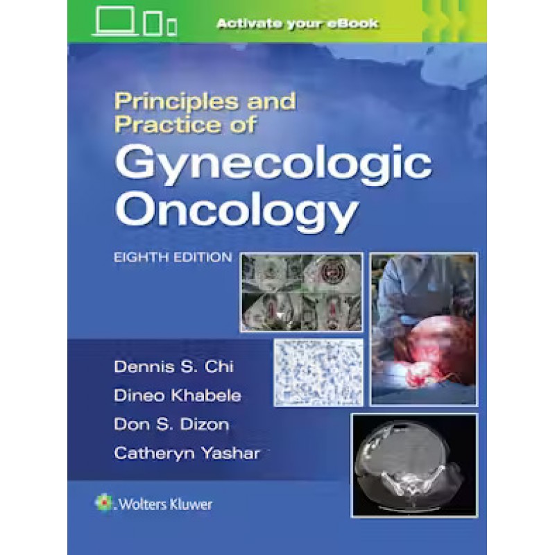 Principles and Practice of Gynecologic Oncology, 8th Edition (ΥΠΟ ΕΚΔΟΣΗ ΙΟΥΝΙΟΣ 2024)