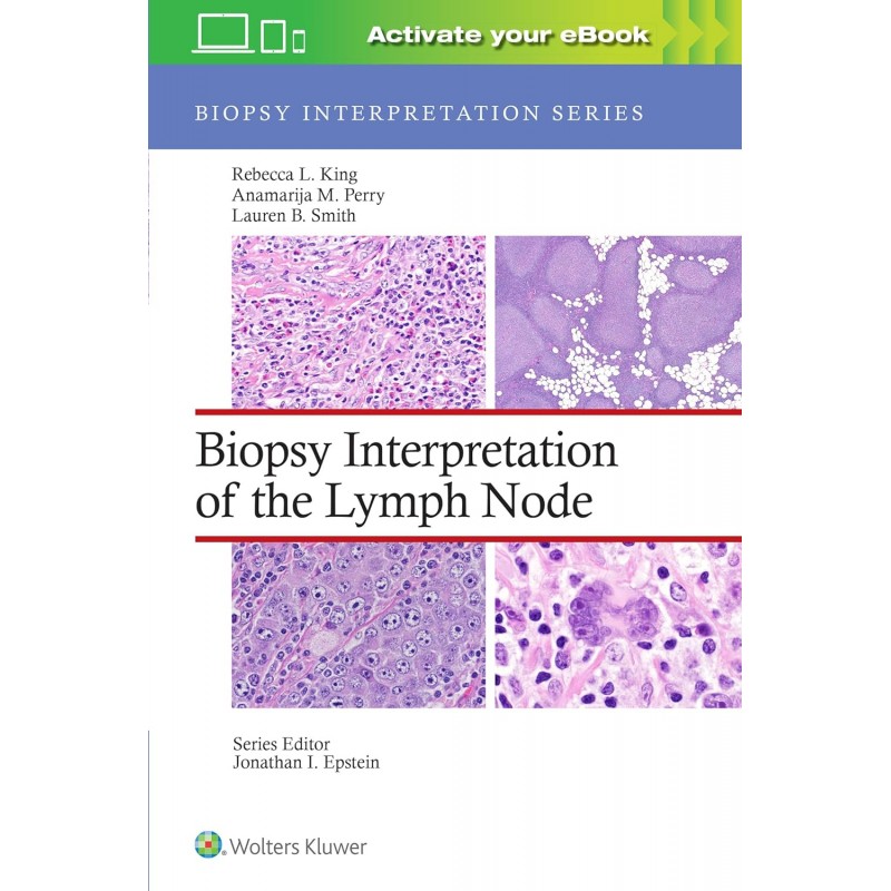 Biopsy Interpretation of the Lymph Node, 1st Εdition, Biopsy Interpretation Series