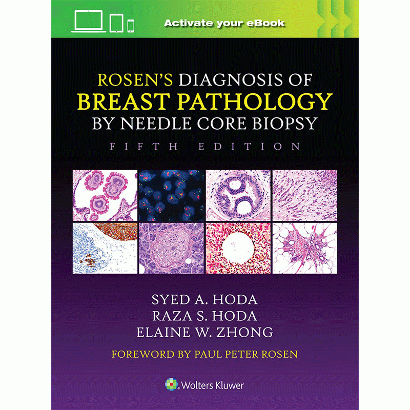 Rosen’s Diagnosis of Breast Pathology by Needle Core Biopsy, 5th Edition