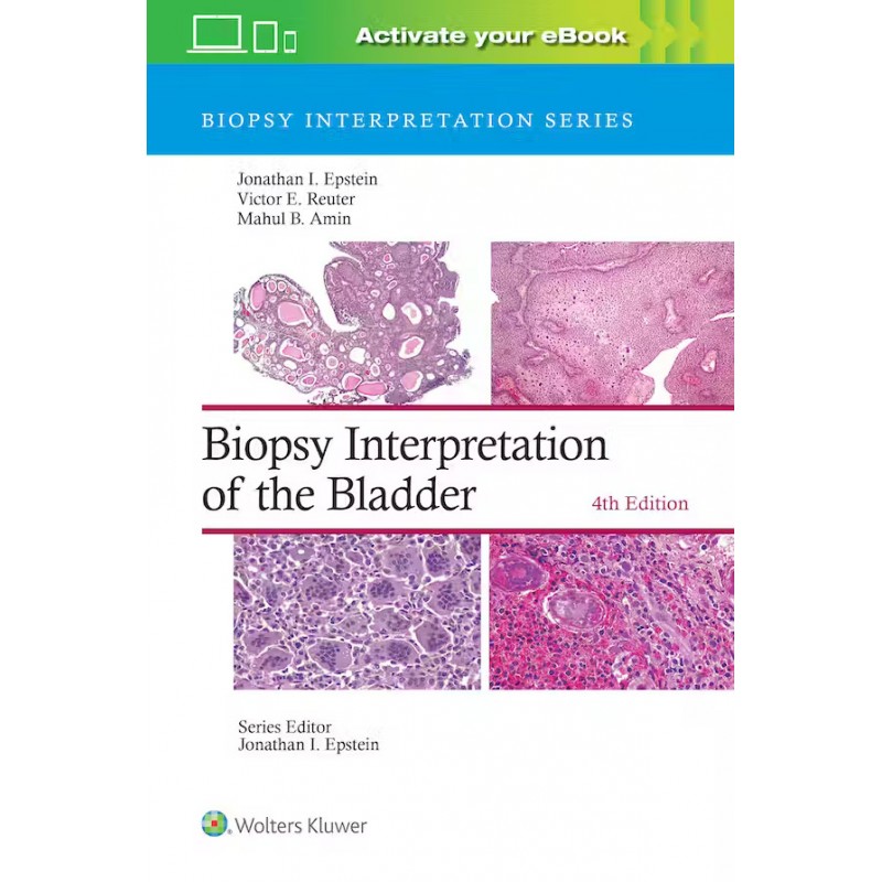 Biopsy Interpretation of the Bladder, 4th Edition, Biopsy Interpretation Series