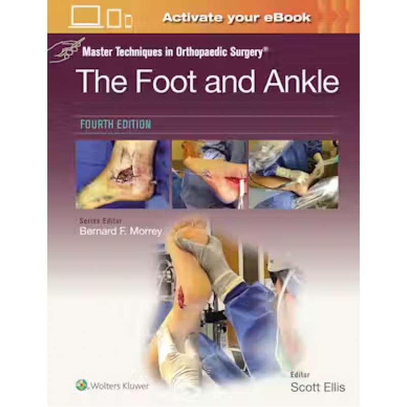 Master Techniques in Orthopaedic Surgery: The Foot and Ankle Fourth edition