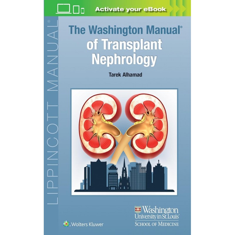 The Washington Manual of Transplant Nephrology, 1st Edition