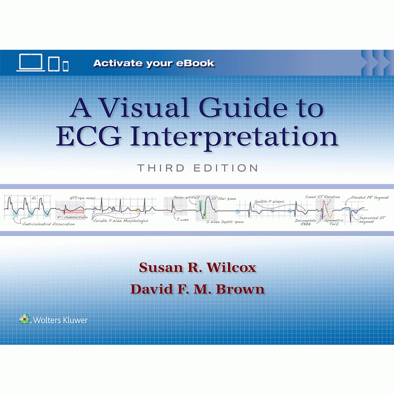 A Visual Guide to ECG Interpretation, 3rd Edition