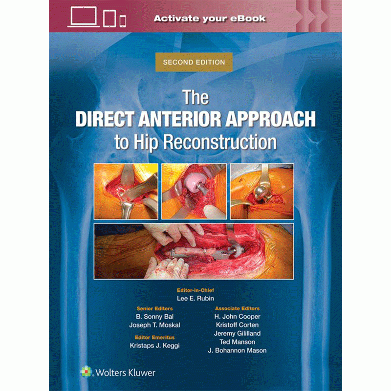 The Direct Anterior Approach to Hip Reconstruction, 2nd Edition