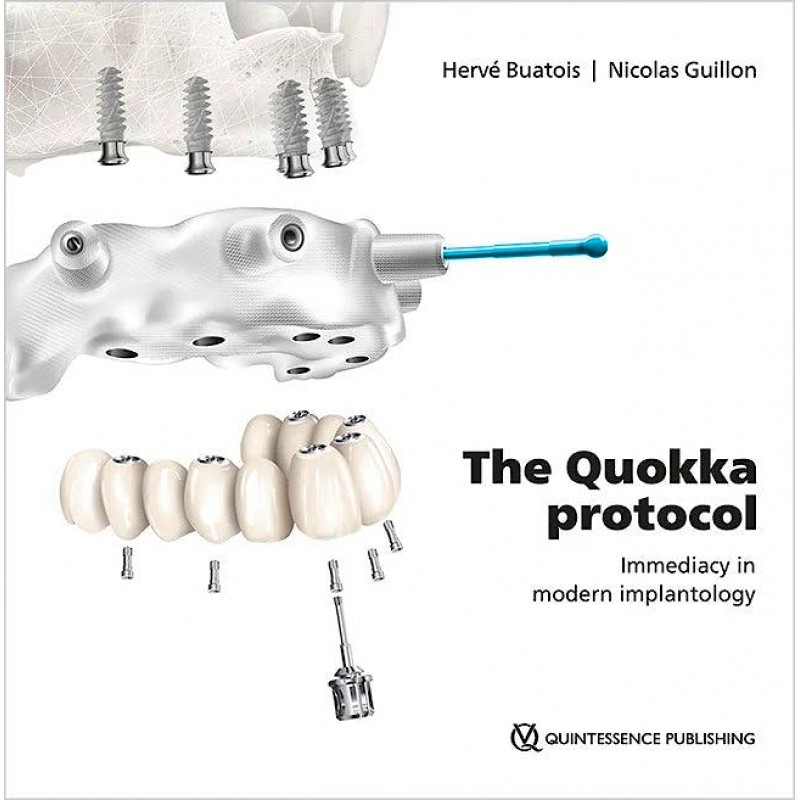 The Quokka Protocol: Immediacy in Modern Implantology, 1st Edition