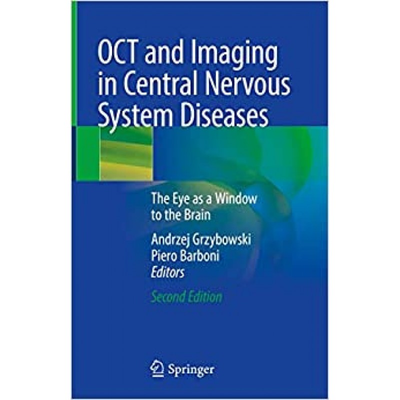 OCT and Imaging in Central Nervous System Diseases