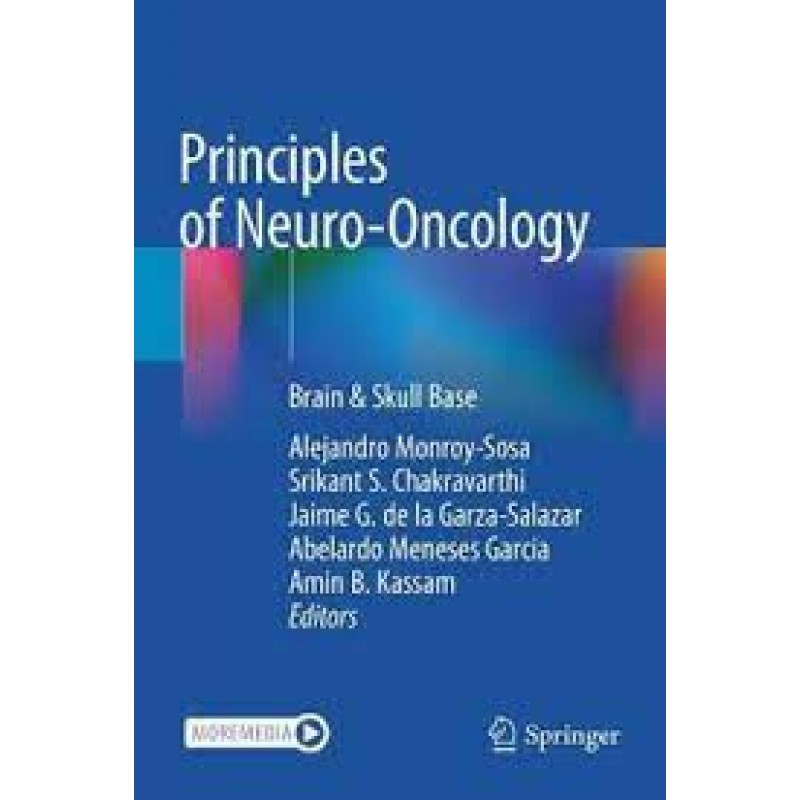  Principles of Neuro-Oncology Brain & Skull Base