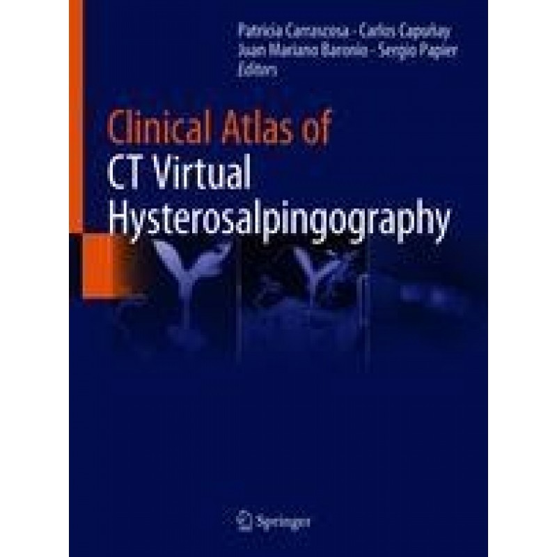 Clinical Atlas of CT Virtual Hysterosalpingography