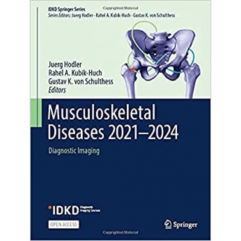 Musculoskeletal Diseases 2021-2024