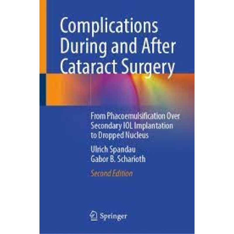  Complications During and After Cataract Surgery  From Phacoemulsification Over Secondary IOL Implantation to Dropped Nucleus