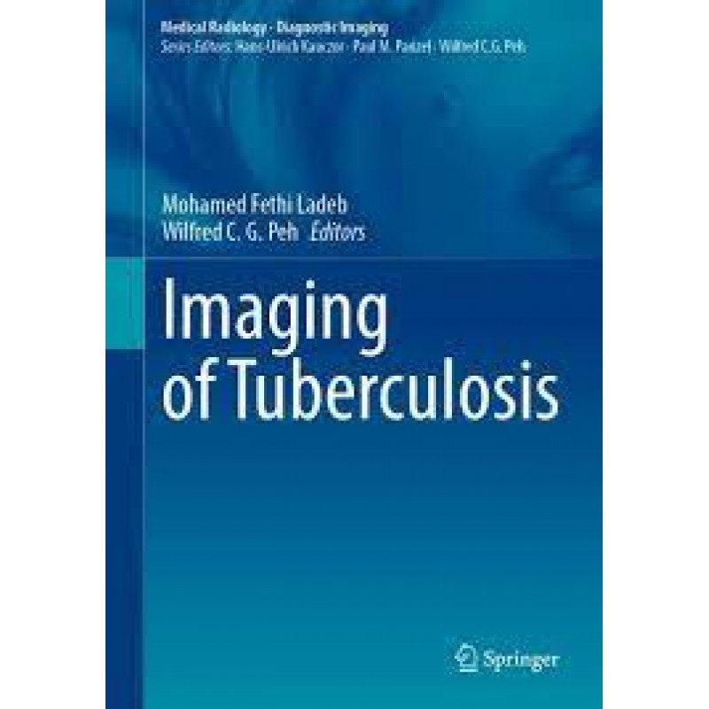 Imaging of Tuberculosis 