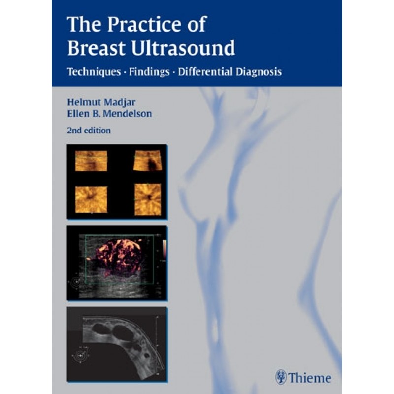 The Practice of Breast Ultrasound, 2E