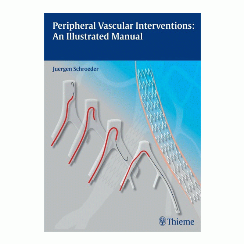 Peripheral Vascular Interventions: An Illustrated Manual