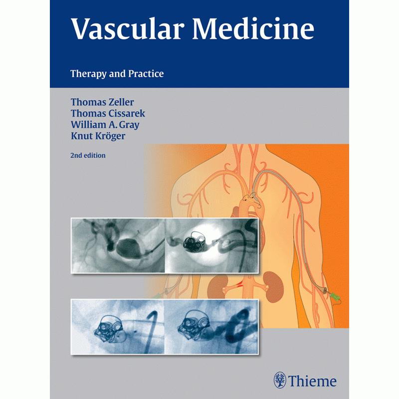 Vascular Medicine: Therapy & Practice, 2nd Edition