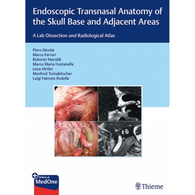 Endoscopic Transnasal Anatomy of the Skull Base and Adjacent Areas - A Lab Dissection and Radiological Atlas 