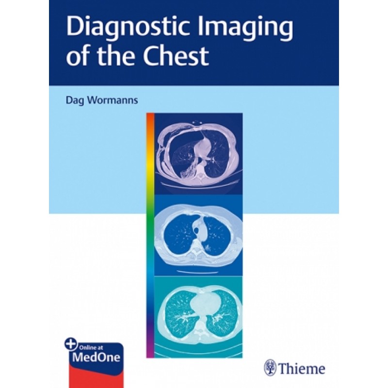 Diagnostic Imaging of the Chest 