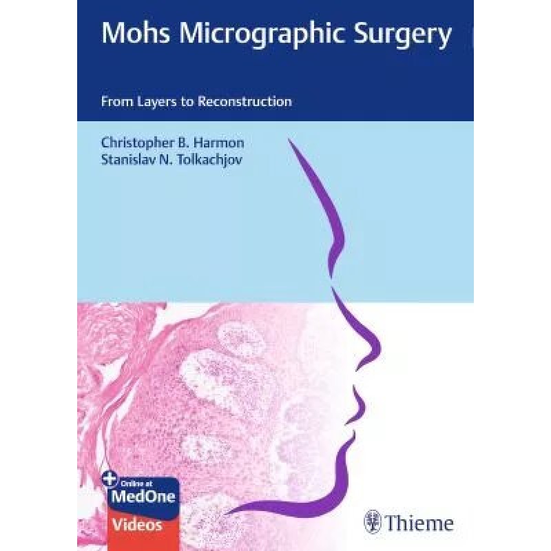  Mohs Micrographic Surgery From Layers to Reconstruction 