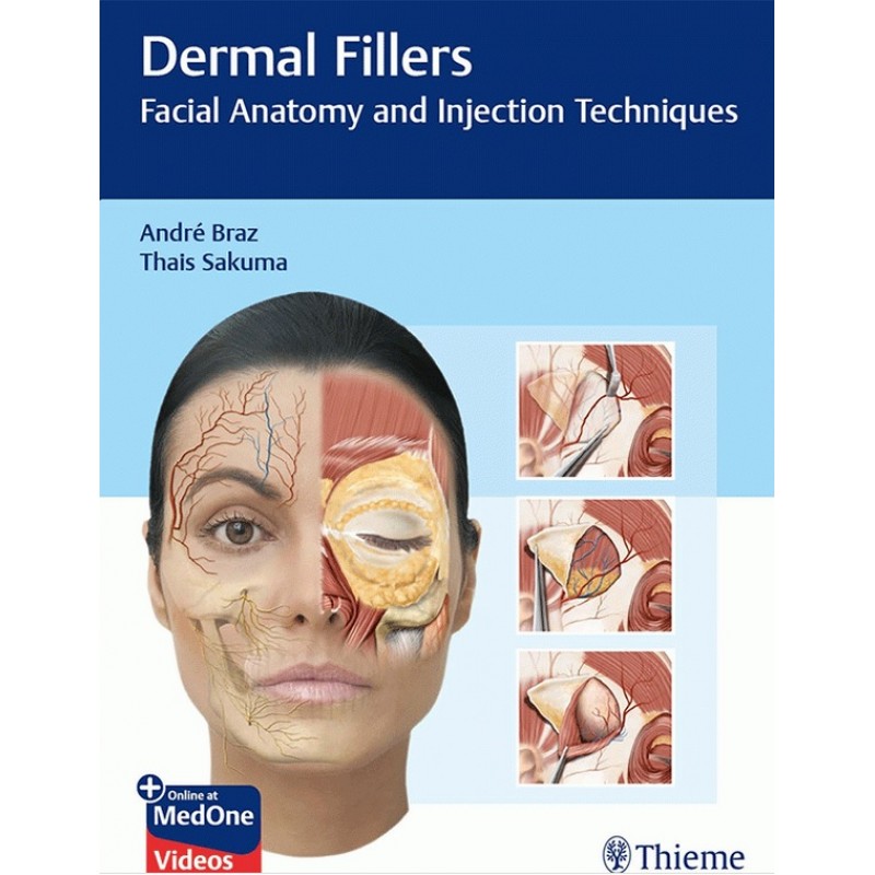 Dermal Fillers: Facial Anatomy and Injection Techniques 