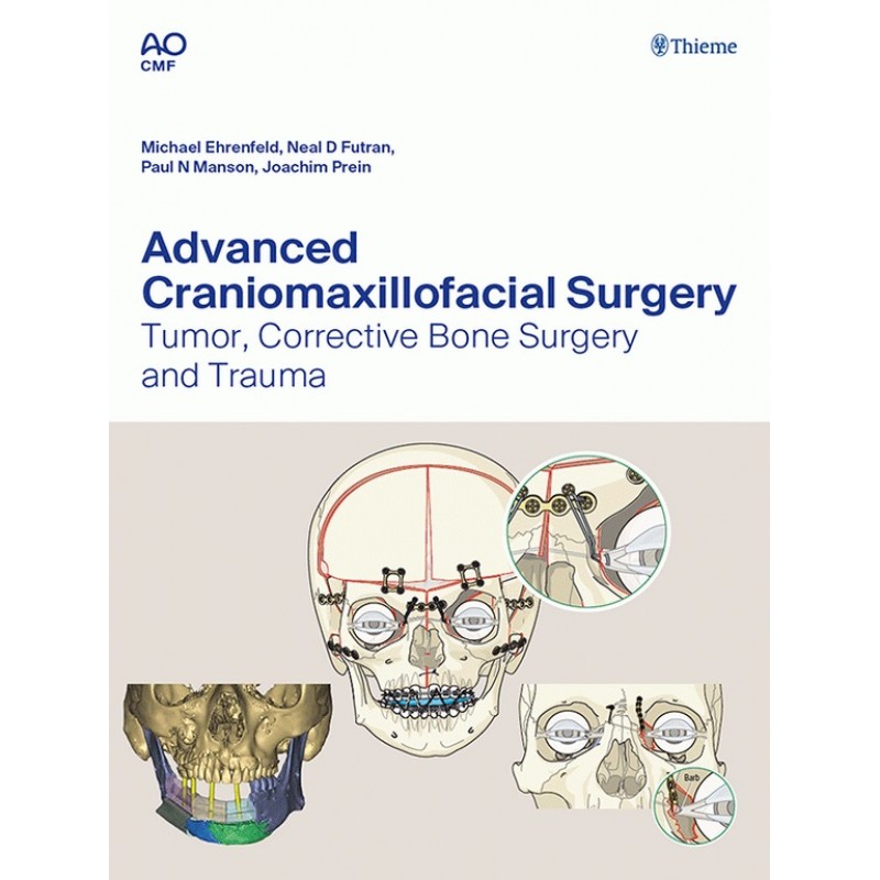 Advanced Craniomaxillofacial Surgery: Tumor, Corrective Bone Surgery, and Trauma 