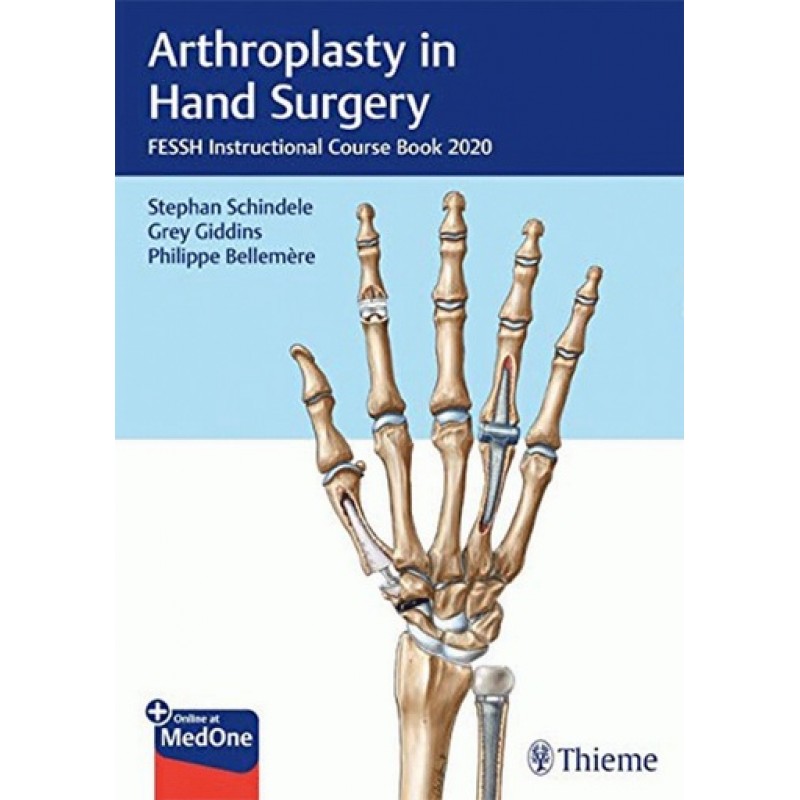 Arthroplasty in Hand Surgery FESSH Instructional Course Book 2020 