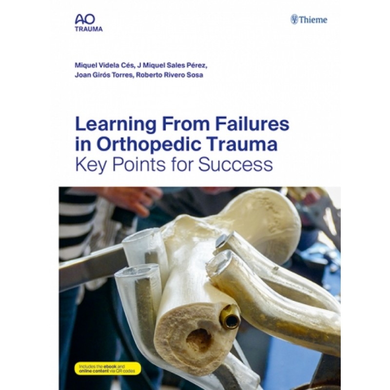 Learning From Failures in Orthopedic Trauma Key Points for Success 