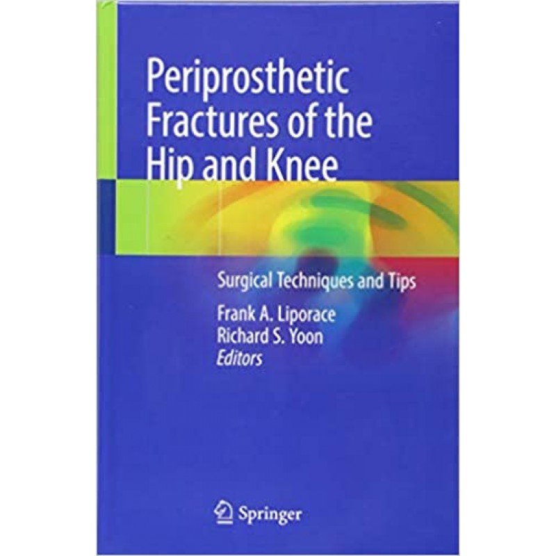 Periprosthetic Fractures of the Hip and Knee