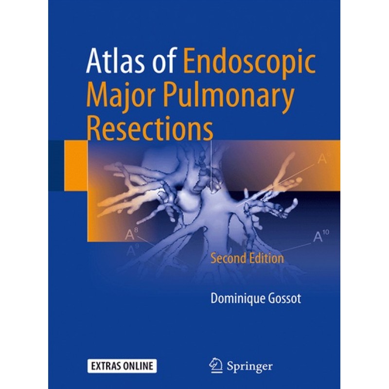 Atlas of Endoscopic Major Pulmonary Resections 2E